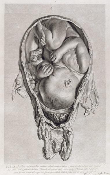 Anatomical drawing of a foetus in the womb pub. 1774