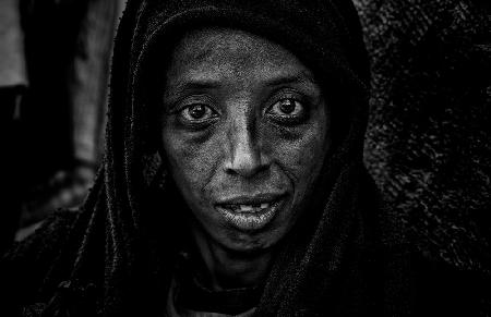 Obdachlose Frau in den Straßen von Addis Abeba – Äthiopien