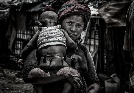 Rohingya-Flüchtlingsmutter und ihr Kind – Bangladesch